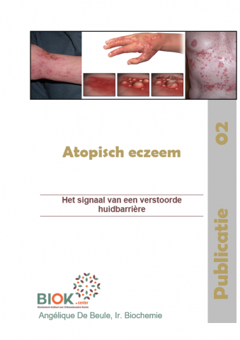 Publié 02 - Eczéma atopique