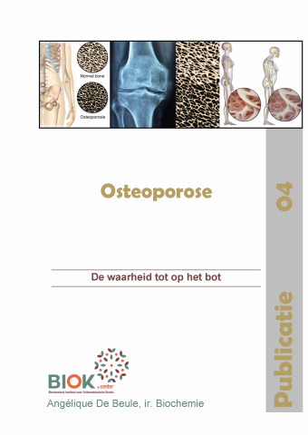Publié 04 - Ostéoporose : la vérité sur les os